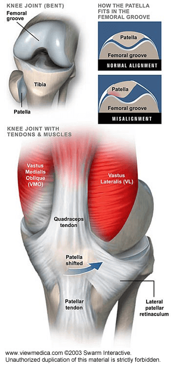 many-of-todays-knee-treatment-solutions-fail-heres-why_img